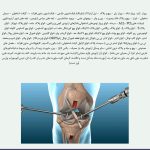 معافیت مالیات ارزش افزوده واردات تجهیزات و ملزومات پزشکی